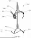 Fig. 37 - APPARATUS AND METHODS FOR TREATING A DEFECTIVE CARDIAC VALVE
