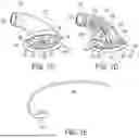Fig. 04 - METHODS AND DEVICES FOR VENTRICULAR RESHAPING AND HEART VALVE RESHAPING