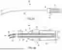 Fig. 11 - METHODS AND DEVICES FOR VENTRICULAR RESHAPING AND HEART VALVE RESHAPING