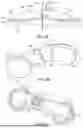 Fig. 16 - METHODS AND DEVICES FOR VENTRICULAR RESHAPING AND HEART VALVE RESHAPING