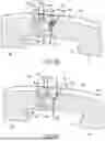 Fig. 17 - METHODS AND DEVICES FOR VENTRICULAR RESHAPING AND HEART VALVE RESHAPING