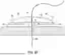 Fig. 18 - METHODS AND DEVICES FOR VENTRICULAR RESHAPING AND HEART VALVE RESHAPING