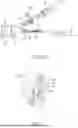 Fig. 20 - METHODS AND DEVICES FOR VENTRICULAR RESHAPING AND HEART VALVE RESHAPING