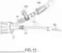 Fig. 22 - METHODS AND DEVICES FOR VENTRICULAR RESHAPING AND HEART VALVE RESHAPING