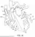 Fig. 23 - METHODS AND DEVICES FOR VENTRICULAR RESHAPING AND HEART VALVE RESHAPING