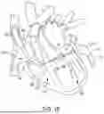 Fig. 26 - METHODS AND DEVICES FOR VENTRICULAR RESHAPING AND HEART VALVE RESHAPING