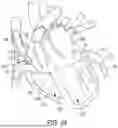 Fig. 31 - METHODS AND DEVICES FOR VENTRICULAR RESHAPING AND HEART VALVE RESHAPING