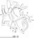 Fig. 37 - METHODS AND DEVICES FOR VENTRICULAR RESHAPING AND HEART VALVE RESHAPING