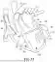 Fig. 38 - METHODS AND DEVICES FOR VENTRICULAR RESHAPING AND HEART VALVE RESHAPING