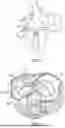 Fig. 50 - METHODS AND DEVICES FOR VENTRICULAR RESHAPING AND HEART VALVE RESHAPING