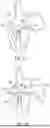 Fig. 56 - METHODS AND DEVICES FOR VENTRICULAR RESHAPING AND HEART VALVE RESHAPING