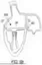 Fig. 59 - METHODS AND DEVICES FOR VENTRICULAR RESHAPING AND HEART VALVE RESHAPING