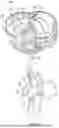 Fig. 62 - METHODS AND DEVICES FOR VENTRICULAR RESHAPING AND HEART VALVE RESHAPING