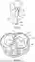 Fig. 65 - METHODS AND DEVICES FOR VENTRICULAR RESHAPING AND HEART VALVE RESHAPING