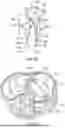 Fig. 68 - METHODS AND DEVICES FOR VENTRICULAR RESHAPING AND HEART VALVE RESHAPING