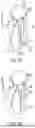 Fig. 69 - METHODS AND DEVICES FOR VENTRICULAR RESHAPING AND HEART VALVE RESHAPING
