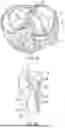 Fig. 71 - METHODS AND DEVICES FOR VENTRICULAR RESHAPING AND HEART VALVE RESHAPING