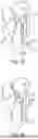 Fig. 72 - METHODS AND DEVICES FOR VENTRICULAR RESHAPING AND HEART VALVE RESHAPING