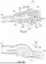 Fig. 74 - METHODS AND DEVICES FOR VENTRICULAR RESHAPING AND HEART VALVE RESHAPING