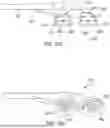 Fig. 78 - METHODS AND DEVICES FOR VENTRICULAR RESHAPING AND HEART VALVE RESHAPING