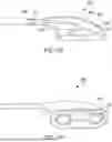 Fig. 80 - METHODS AND DEVICES FOR VENTRICULAR RESHAPING AND HEART VALVE RESHAPING