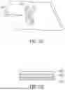 Fig. 88 - METHODS AND DEVICES FOR VENTRICULAR RESHAPING AND HEART VALVE RESHAPING