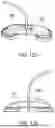 Fig. 89 - METHODS AND DEVICES FOR VENTRICULAR RESHAPING AND HEART VALVE RESHAPING