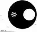 Fig. 16 - SYNCHRONIZED PIEZO DRIVING FOR PHASE CONTROL AND PUMP AND VALVE TIMING FOR A UROLOGY IMPLANTABLE MEDICAL DEVICE