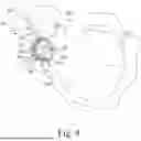 Fig. 09 - APPARATUS AND METHOD FOR LOCKING AN ACETABULAR LINER TO AN ACETABULAR CUP