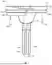 Fig. 02 - KNEE REPLACEMENT IMPLANT HAVING STACKABLE SPACERS