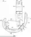 Fig. 03 - KNEE REPLACEMENT IMPLANT HAVING STACKABLE SPACERS