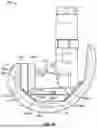 Fig. 05 - KNEE REPLACEMENT IMPLANT HAVING STACKABLE SPACERS