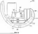 Fig. 06 - KNEE REPLACEMENT IMPLANT HAVING STACKABLE SPACERS
