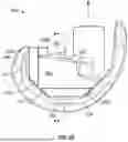 Fig. 07 - KNEE REPLACEMENT IMPLANT HAVING STACKABLE SPACERS
