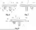 Fig. 04 - TIBIAL BASEPLATE FOR TIBIAL COMPONENT OF A KNEE PROSTHESIS, TIBIAL COMPONENT COMPRISING THE TIBIAL BASEPLATE AND METHOD FOR MANUFACTURING THE TIBIAL BASEPLATE
