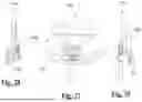 Fig. 13 - TIBIAL BASEPLATE FOR TIBIAL COMPONENT OF A KNEE PROSTHESIS, TIBIAL COMPONENT COMPRISING THE TIBIAL BASEPLATE AND METHOD FOR MANUFACTURING THE TIBIAL BASEPLATE