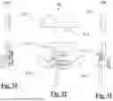 Fig. 15 - TIBIAL BASEPLATE FOR TIBIAL COMPONENT OF A KNEE PROSTHESIS, TIBIAL COMPONENT COMPRISING THE TIBIAL BASEPLATE AND METHOD FOR MANUFACTURING THE TIBIAL BASEPLATE