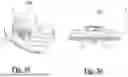 Fig. 16 - TIBIAL BASEPLATE FOR TIBIAL COMPONENT OF A KNEE PROSTHESIS, TIBIAL COMPONENT COMPRISING THE TIBIAL BASEPLATE AND METHOD FOR MANUFACTURING THE TIBIAL BASEPLATE