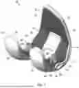 Fig. 02 - KNEE REPLACEMENT IMPLANTS AND INSTRUMENTS