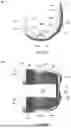 Fig. 03 - KNEE REPLACEMENT IMPLANTS AND INSTRUMENTS