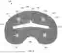 Fig. 06 - KNEE REPLACEMENT IMPLANTS AND INSTRUMENTS