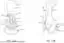 Fig. 12 - JOINT REPLACEMENT ARTHROPLASTY AND JOINT RESURFACING ARTHROPLASTY IMPLANT, METHOD OF IMPLANTATION, AND METHOD OF USING SAME
