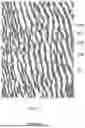 Fig. 18 - INTERBODY FUSION DEVICE COMPRISING TEXTURED SURFACES