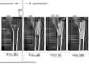 Fig. 11 - SYSTEMS AND METHODS FOR SURGICAL REGISTRATION