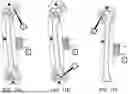 Fig. 26 - SYSTEMS AND METHODS FOR SURGICAL REGISTRATION