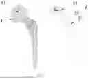 Fig. 02 - PREPARATION METHOD OF A HIP JOINT BONE CEMENT PLACEHOLDER