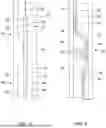 Fig. 04 - STENT DESIGN FOR ENHANCED DRAINAGE