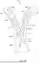 Fig. 10 - STENT DESIGN FOR ENHANCED DRAINAGE