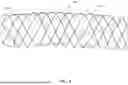 Fig. 05 - PSEUDO HOOKED WIRE STENT