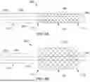 Fig. 09 - ENDOPROSTHESIS WITH IMPROVED CHARACTERISTICS